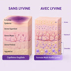 Lyvine